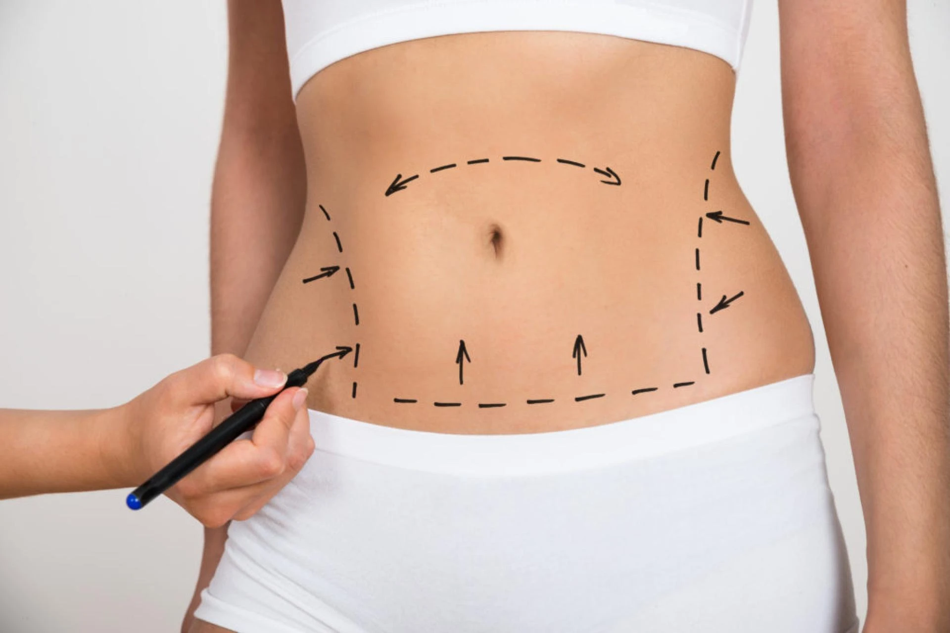 Recovery and Permanent Results with Liposuction in Dubai