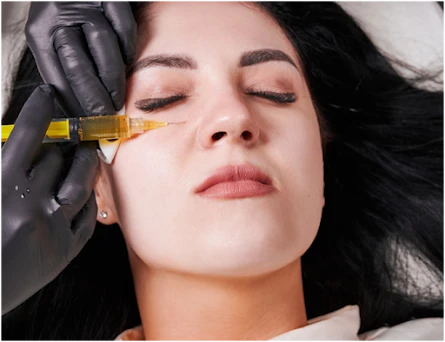How Dermal Fillers Restore Facial Volume