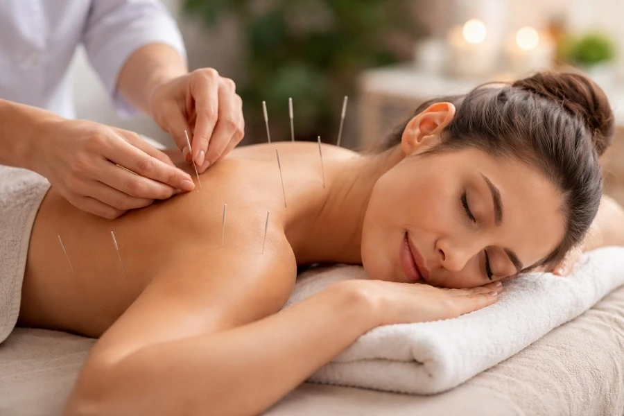 Why Choose Complete Acupuncture Treatment Chicago for Natural Healing