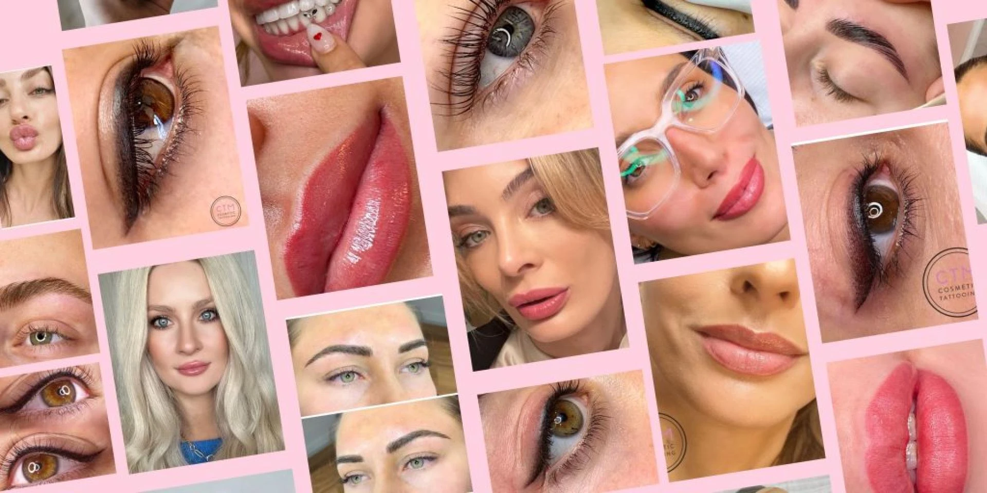 Why Pico laser tattoo removal is ideal for sensitive skin