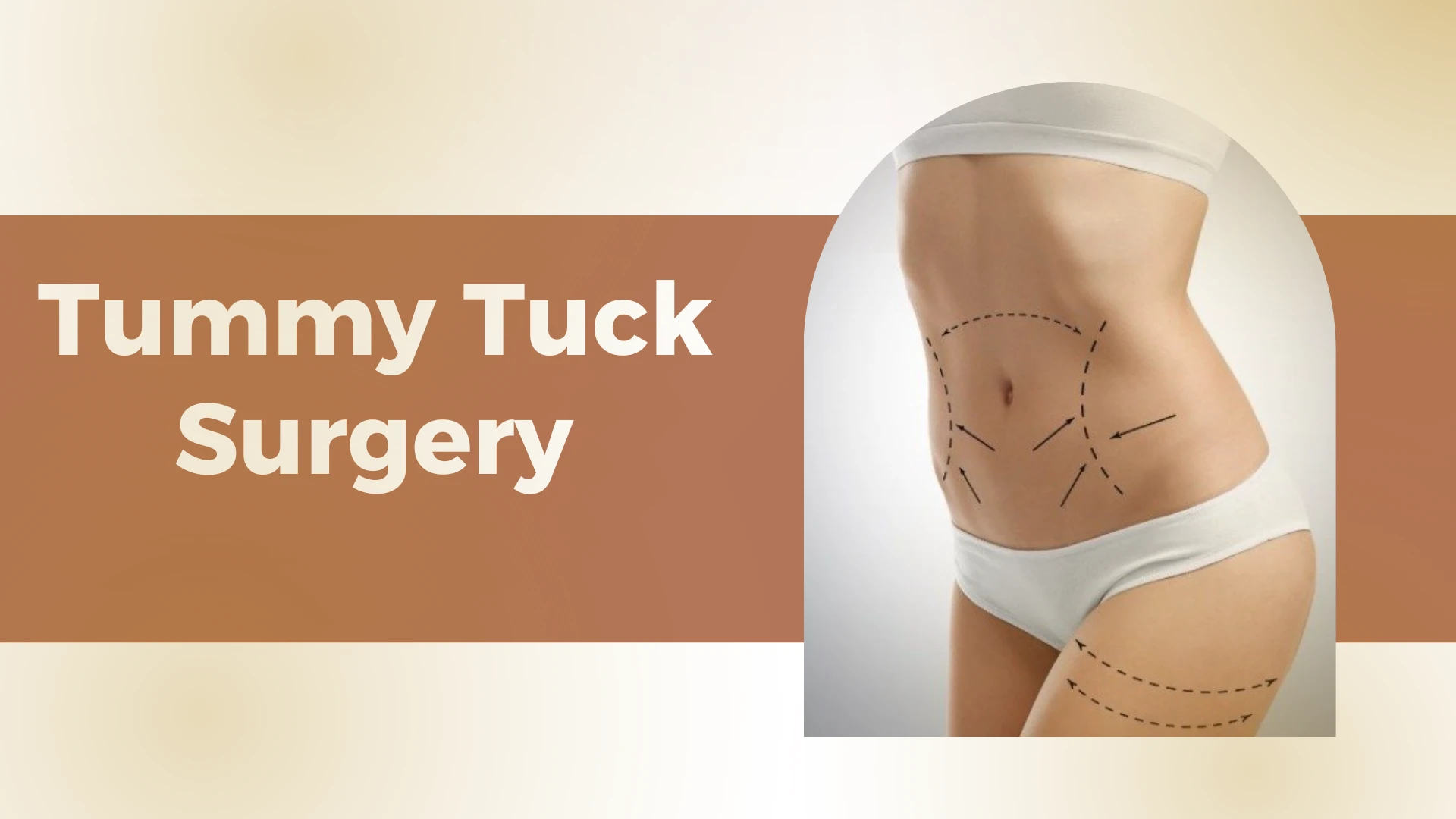 Tummy Tuck Surgery: Procedure, Benefits, and Recovery Guide