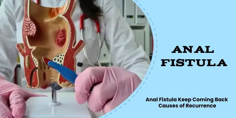 How to Ensure a Recurrence-Free Recovery After Anal Fistula Surgery in Pune