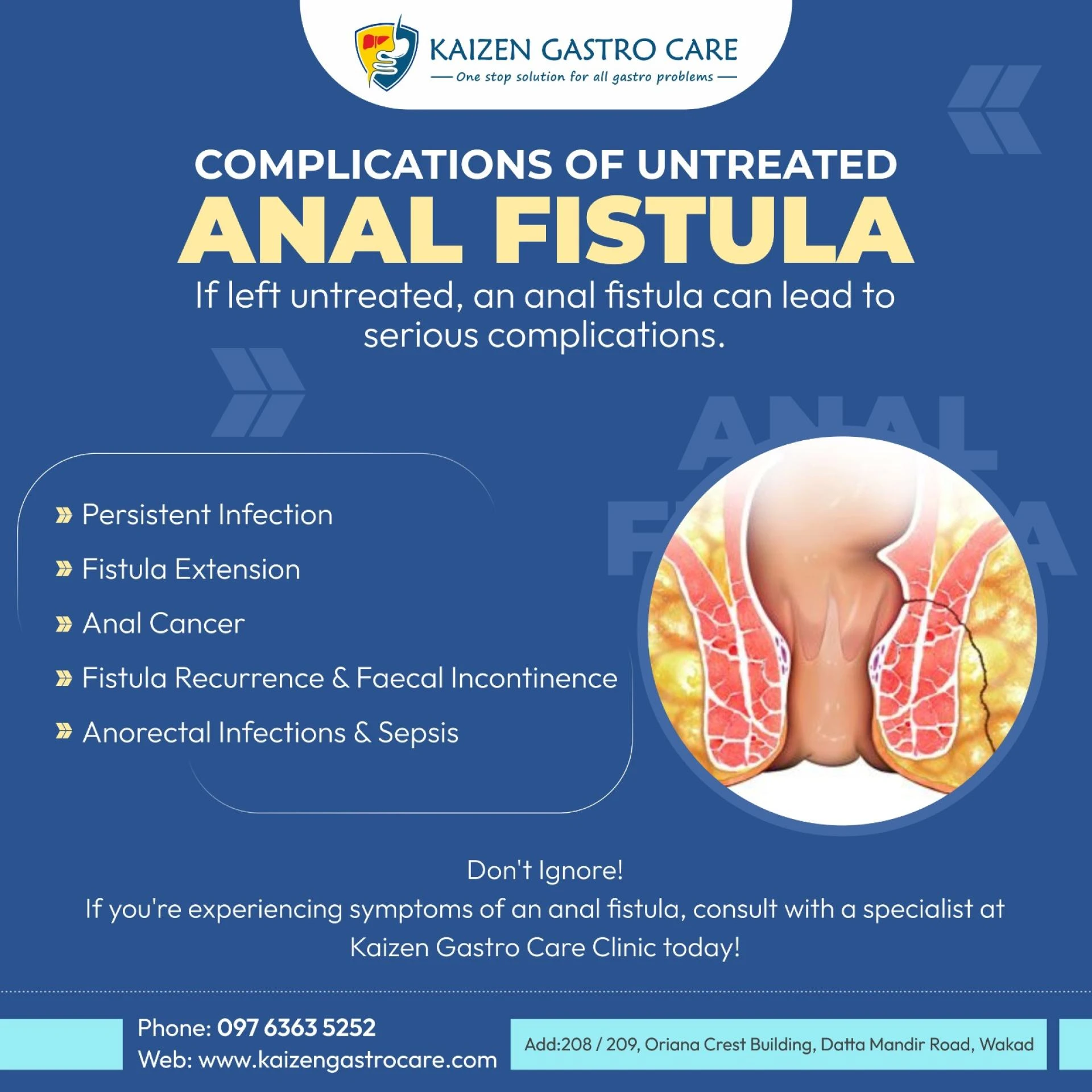Why Consulting a Dedicated Fistula Specialist in Pune is Crucial for a Successful Recovery