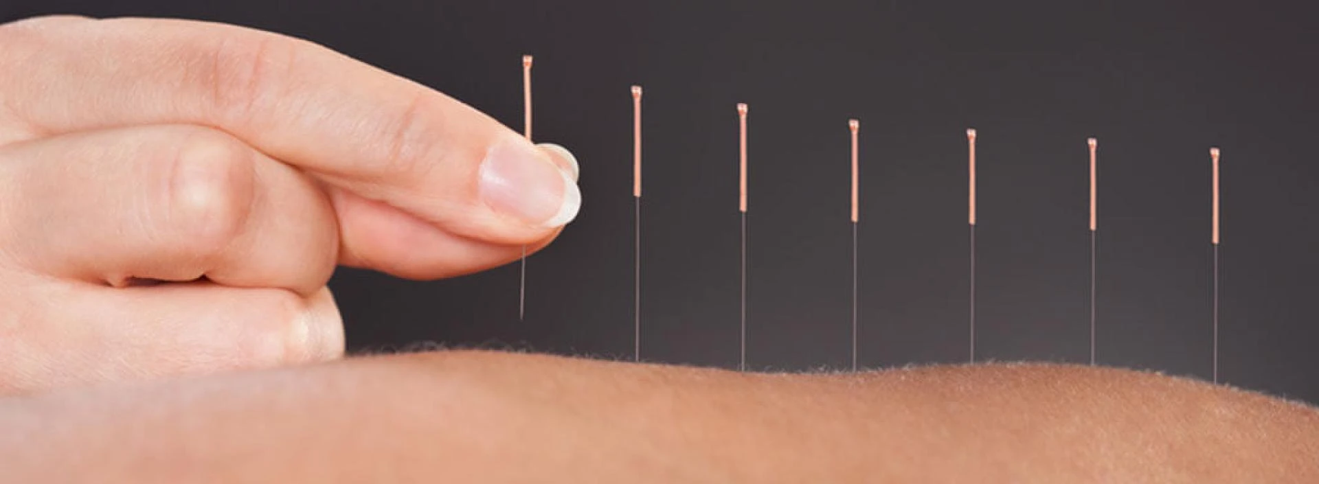 The Role of the Best Acupuncturist in Long Island in Managing Pain