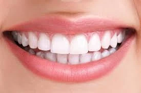 Professional Teeth Whitening Henderson vs Store Kits: Which Is Better?