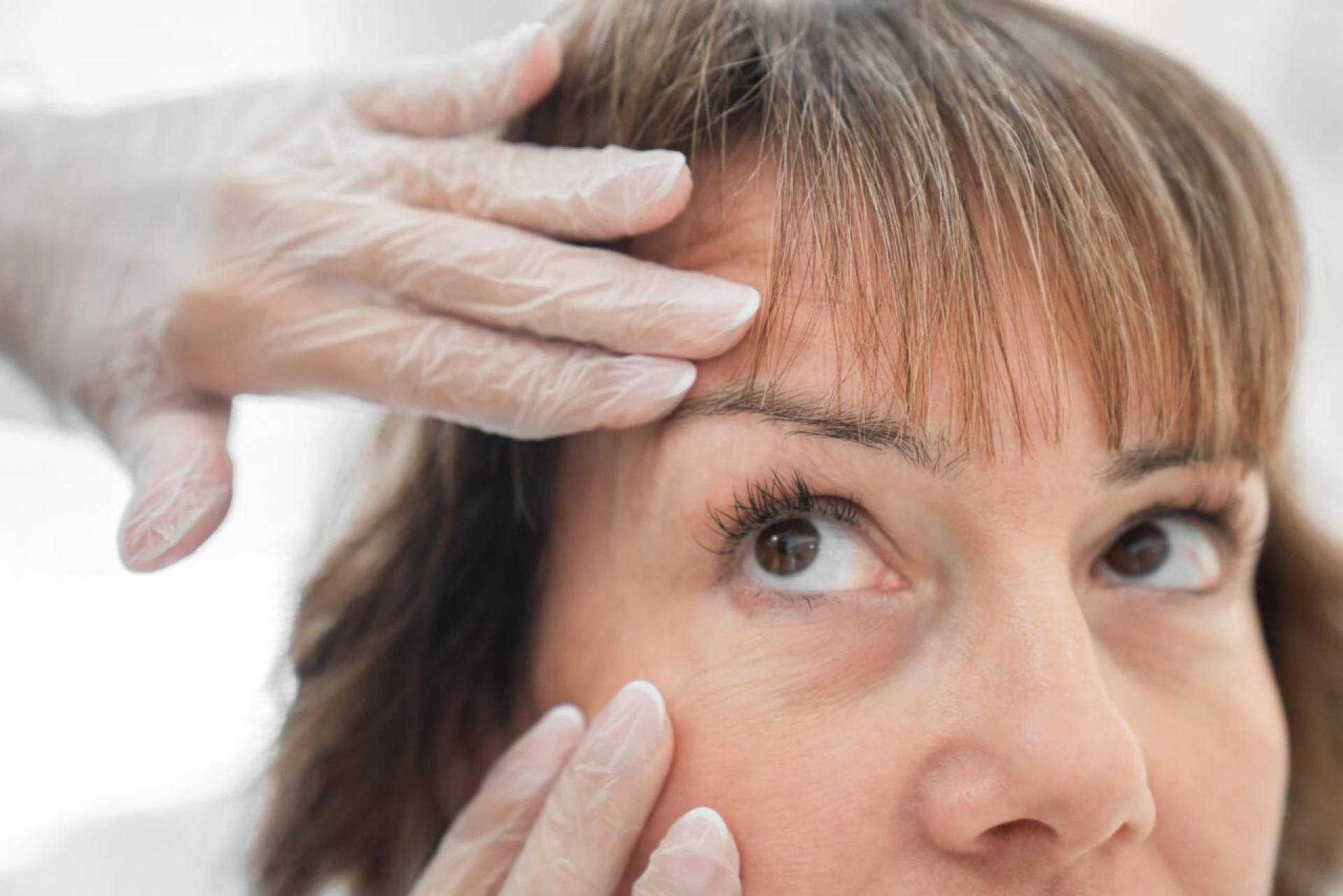 What Is the Difference Between Upper and Lower Eyelid Surgery or Blepharoplasty?