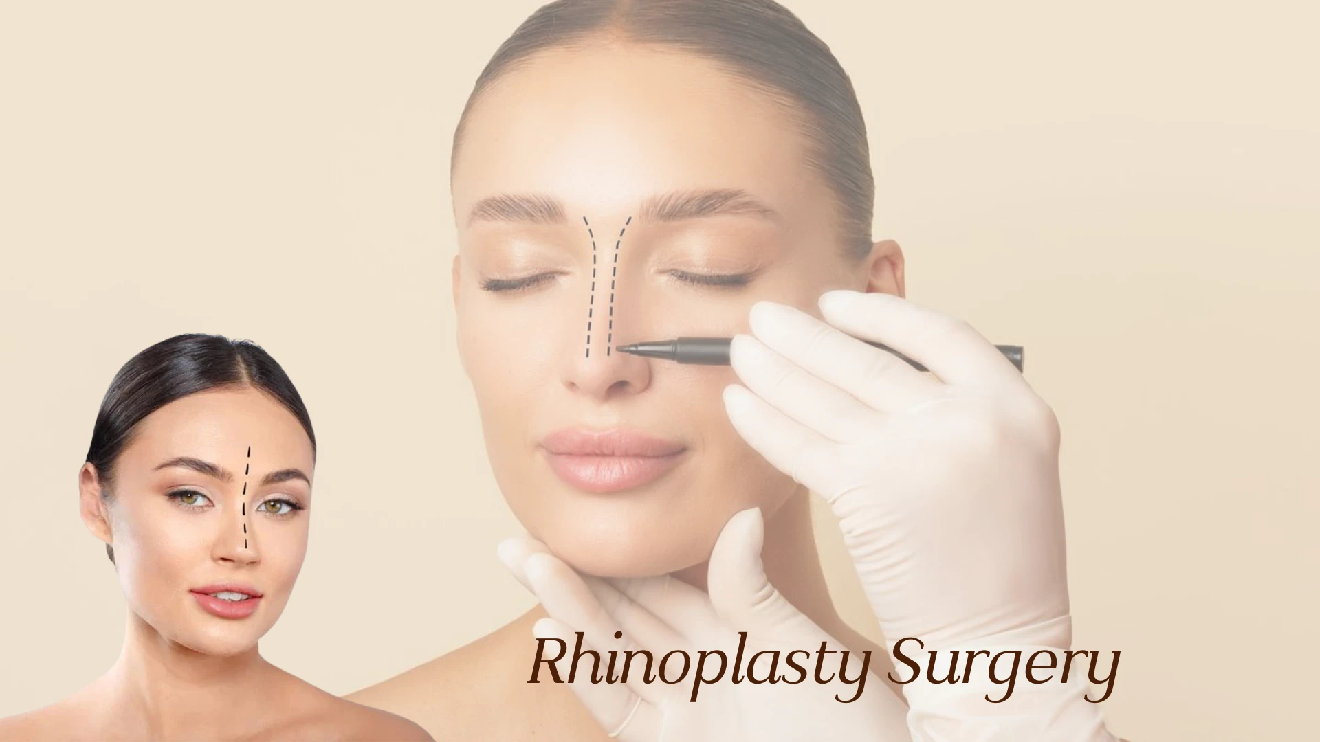 Complete Guide to Rhinoplasty Surgery: Benefits, Procedure & Recovery