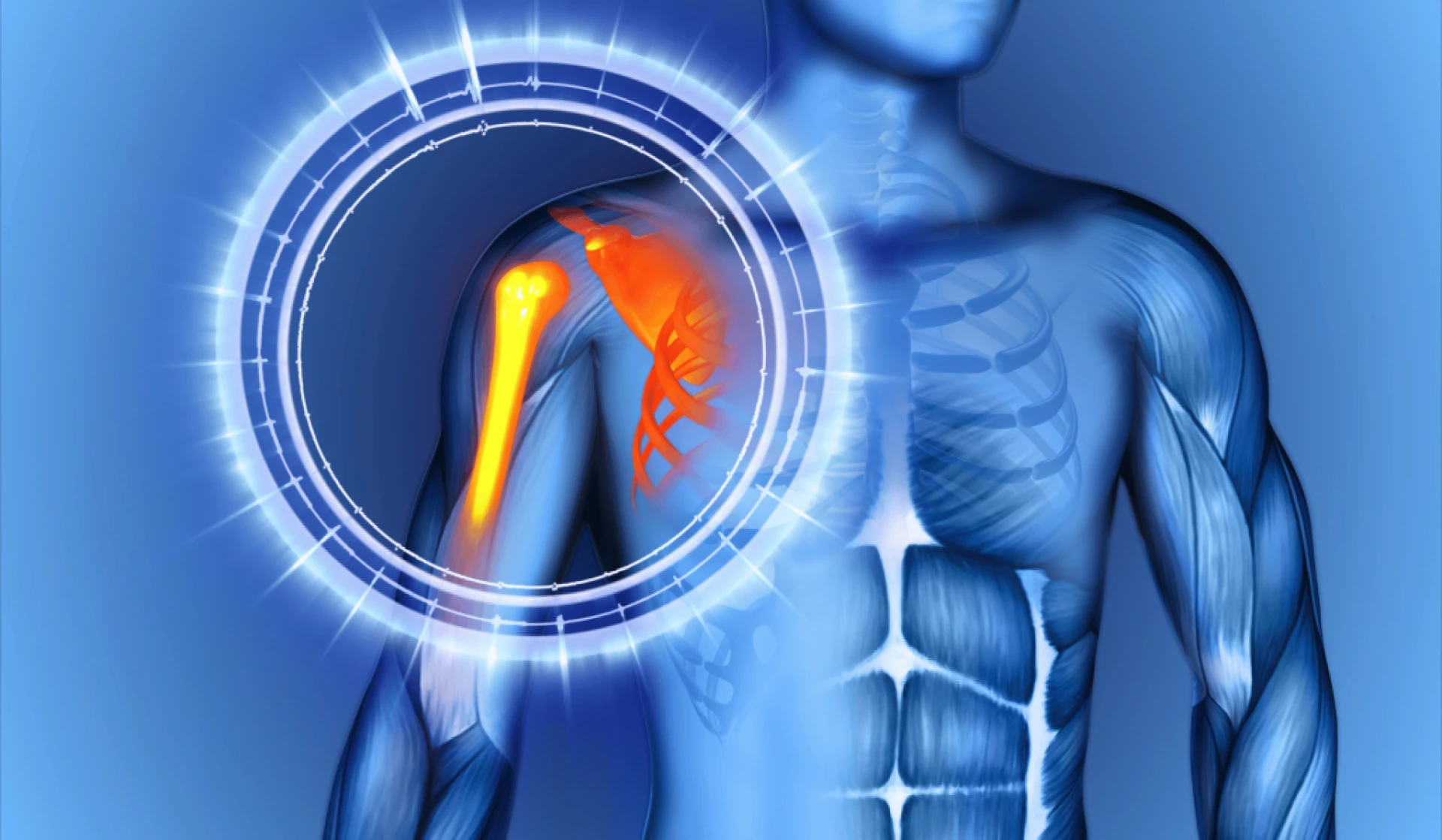 Comprehensive Guide to Shoulder Impingement Syndrome: Diagnosis and Treatment