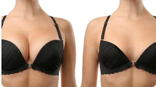 Best Doctor for Nipple Discharge Treatment Pune