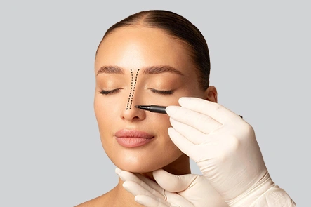 What Is the Procedure of Rhinoplasty Surgery?