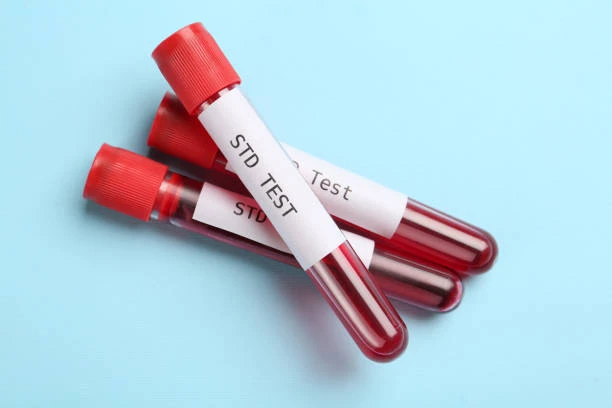 STD Test in Dubai