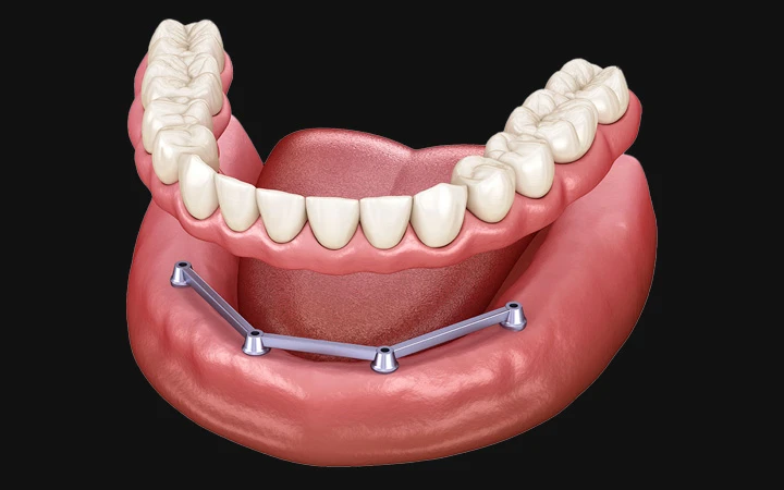 The Art of Smile Enhancement: Expert Dental Surgeons and Aesthetic Reconstruction