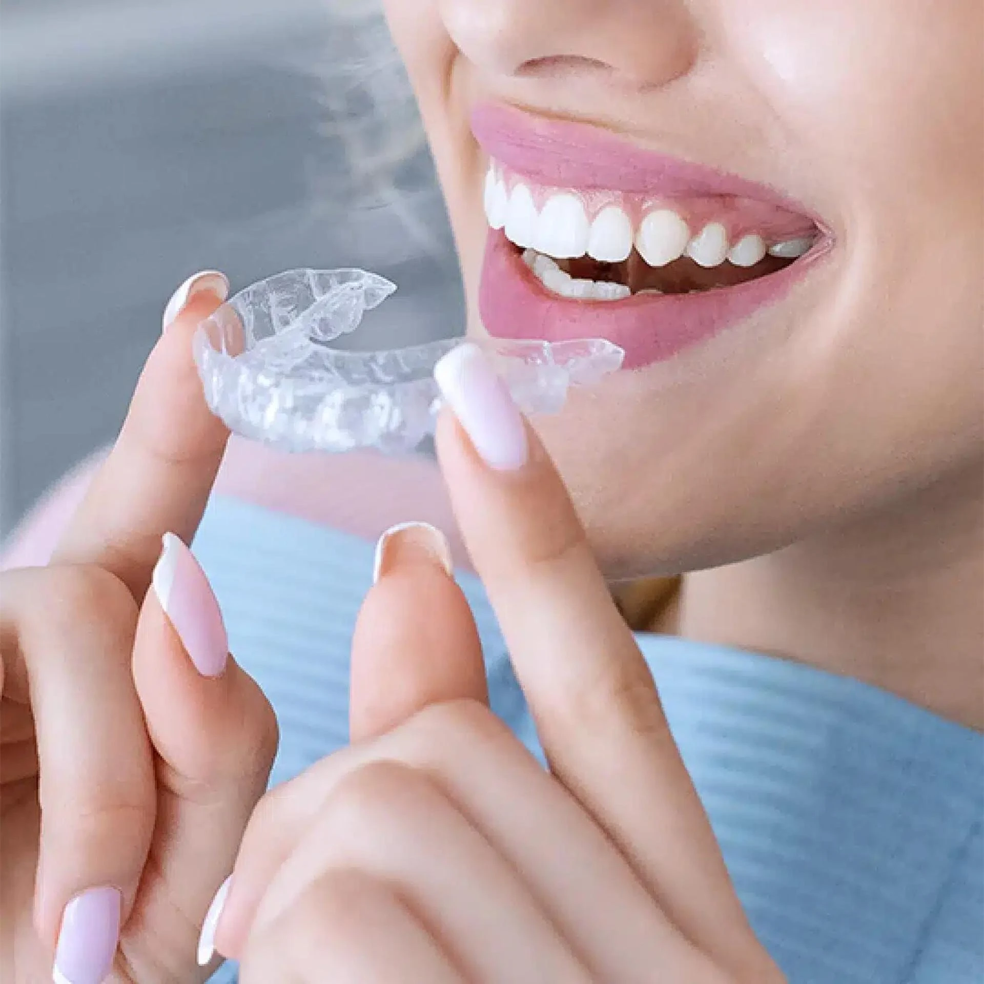 Invisalign London, Ontario: A New Concept in Orthodontics and a New Approach in Dentistry
