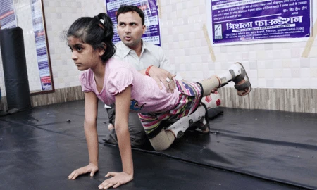 Feeding and Swallowing Difficulties in Dyskinetic Cerebral Palsy