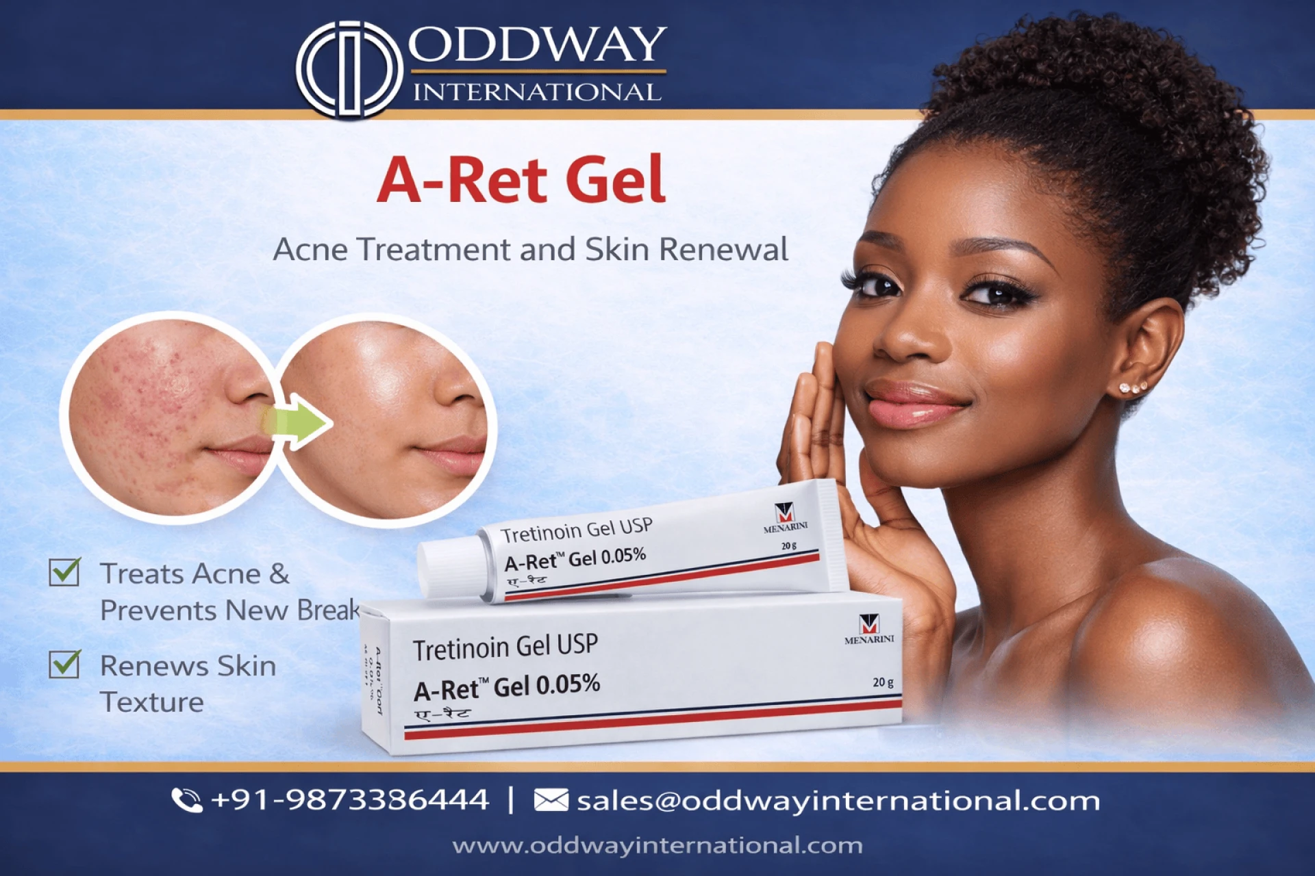 A Ret Gel | Tretinoin a ret gel - Oddway International