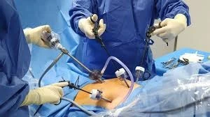 What Is Laparoscopic Surgery and How Does It Work?