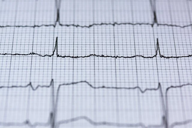 CARDIOLOGY Diagnosis and Tests: Early Detection for Better Heart Health