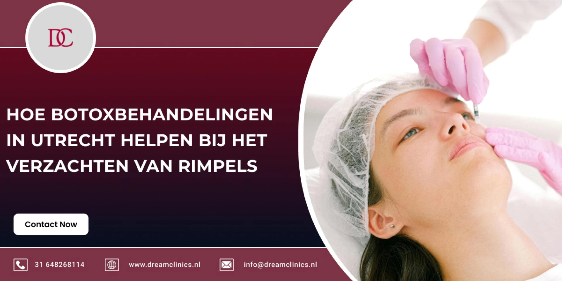Hoe Botoxbehandelingen in Utrecht Helpen bij het Verzachten van Rimpels
