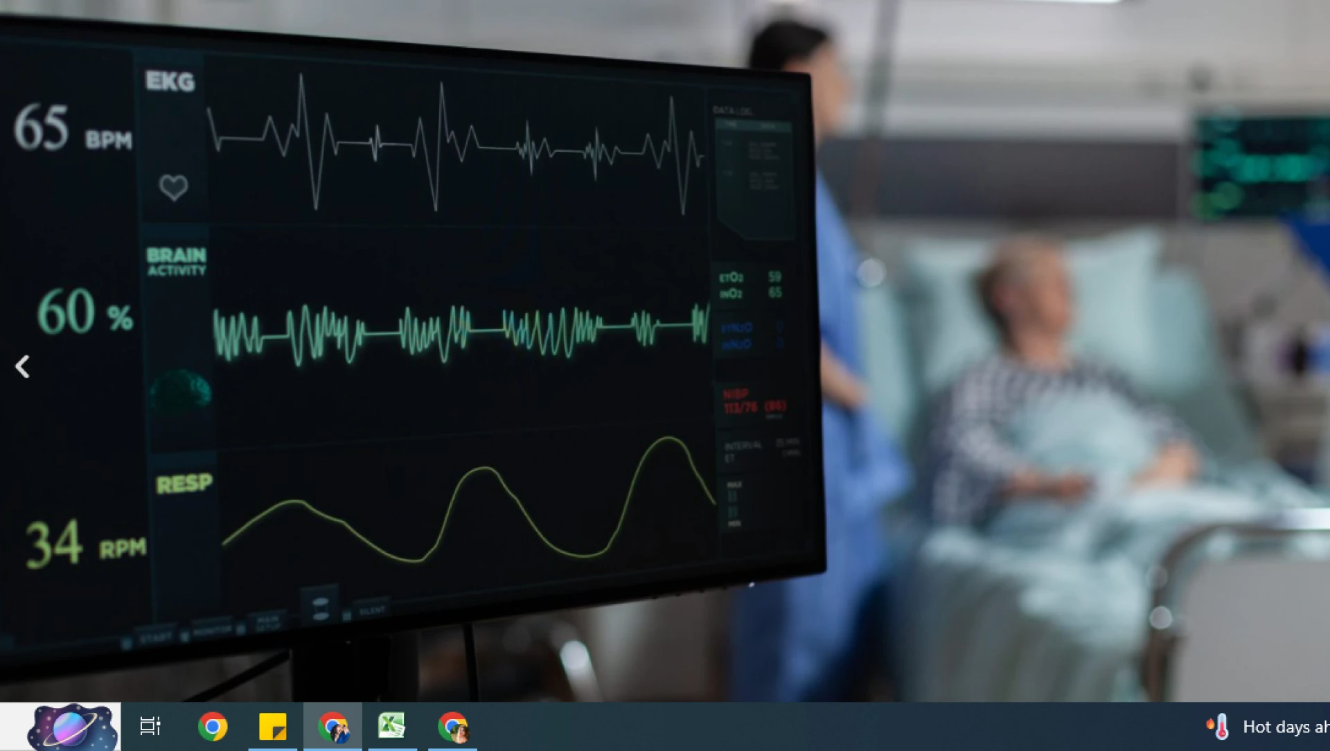 Telemedicine Icu: Improving Patient Outcomes Through Remote Monitoring