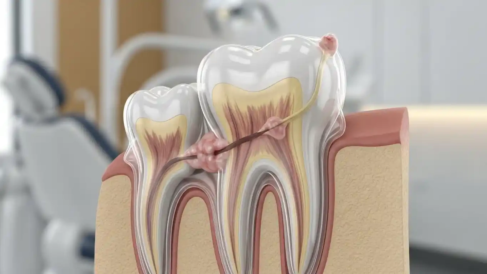 Diabetics and Root Canals: Special Considerations Before the Procedure
