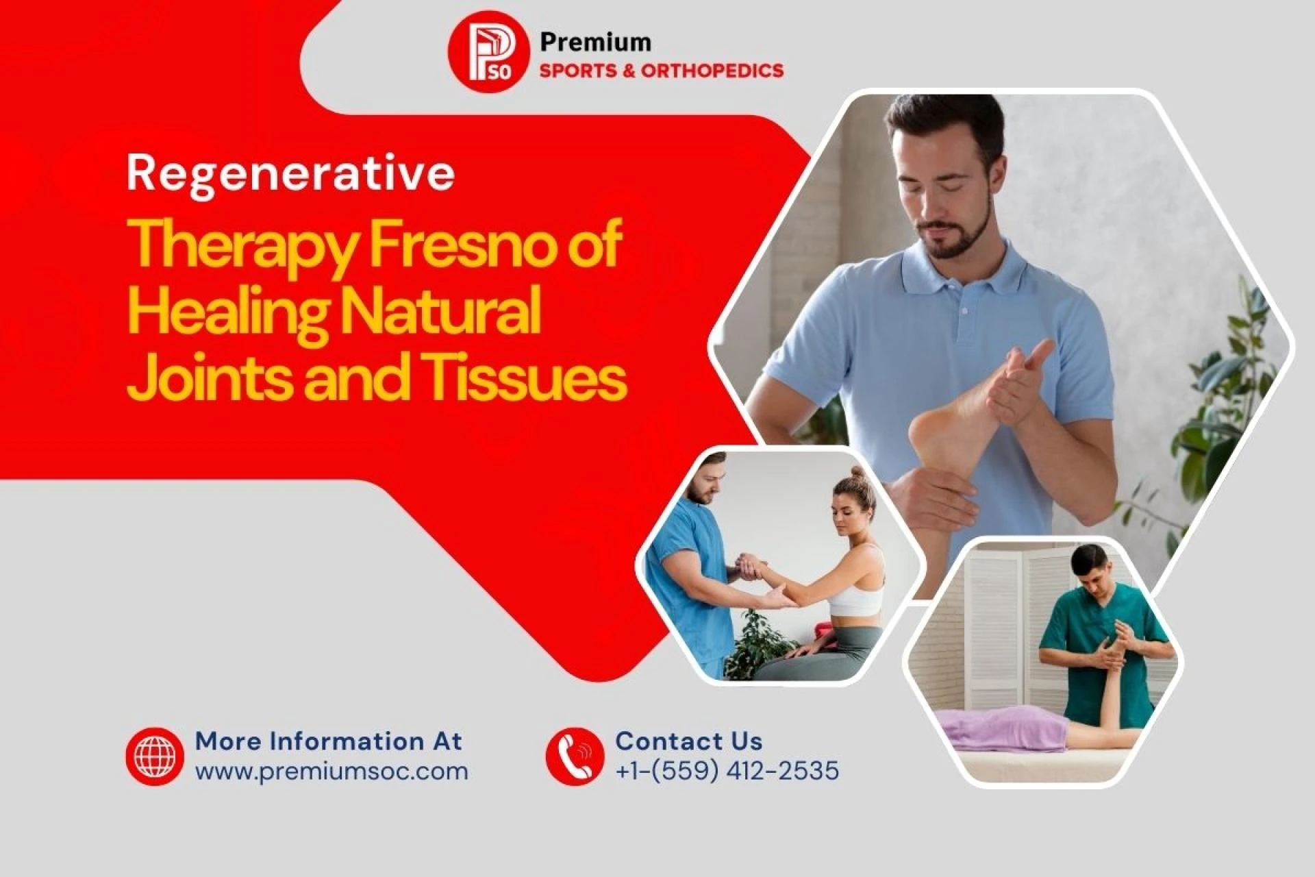 Regenerative Therapy Fresno of Healing Natural Joints and Tissues