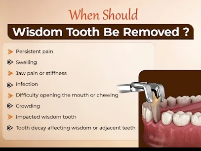 Wisdom Tooth Removal Treatment Near Madinaguda: When Is Surgery Necessary?