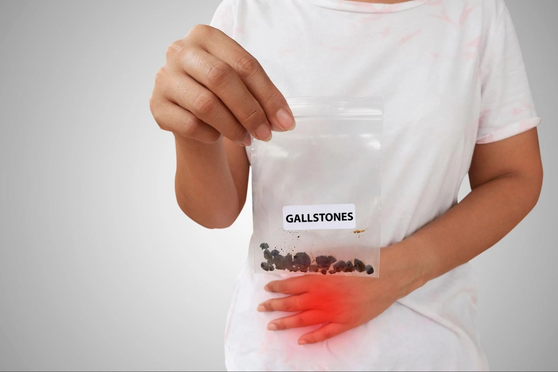 Gallbladder Stone Surgery in Delhi : Expert Advice from the Best Cancer Surgeon