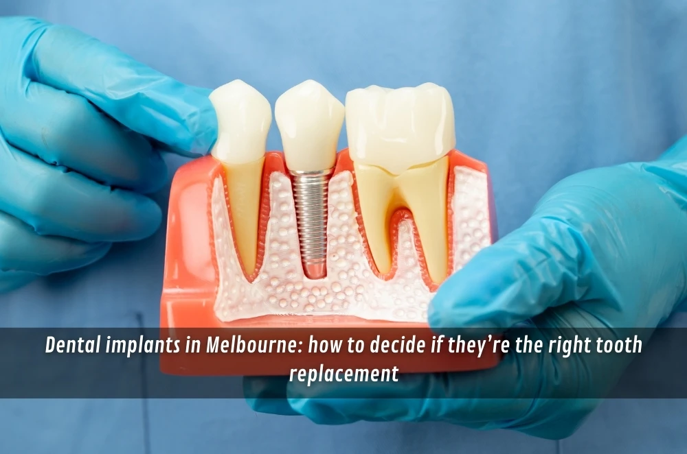 Dental implants in Melbourne: how to decide if they’re the right tooth replacement