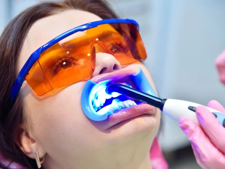 10 Ways to Save Money on Teeth Whitening Treatments
