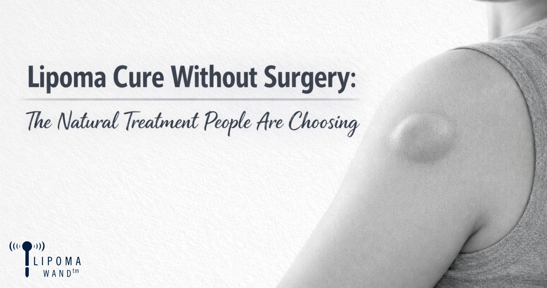 Exploring Effective Options for Lipoma Removal Natural Care at Home