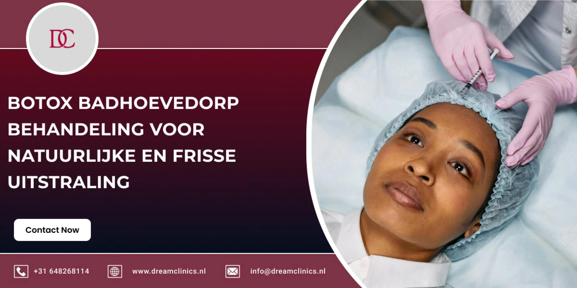 Botox Badhoevedorp Behandeling voor Natuurlijke en Frisse Uitstraling