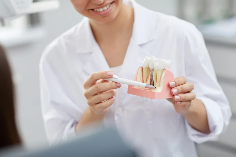 Why Dental Implants Miami FL Are a Top Choice for Missing Teeth