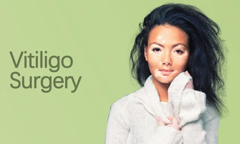 From Diagnosis to Treatment: A Complete Guide to Managing Vitiligo