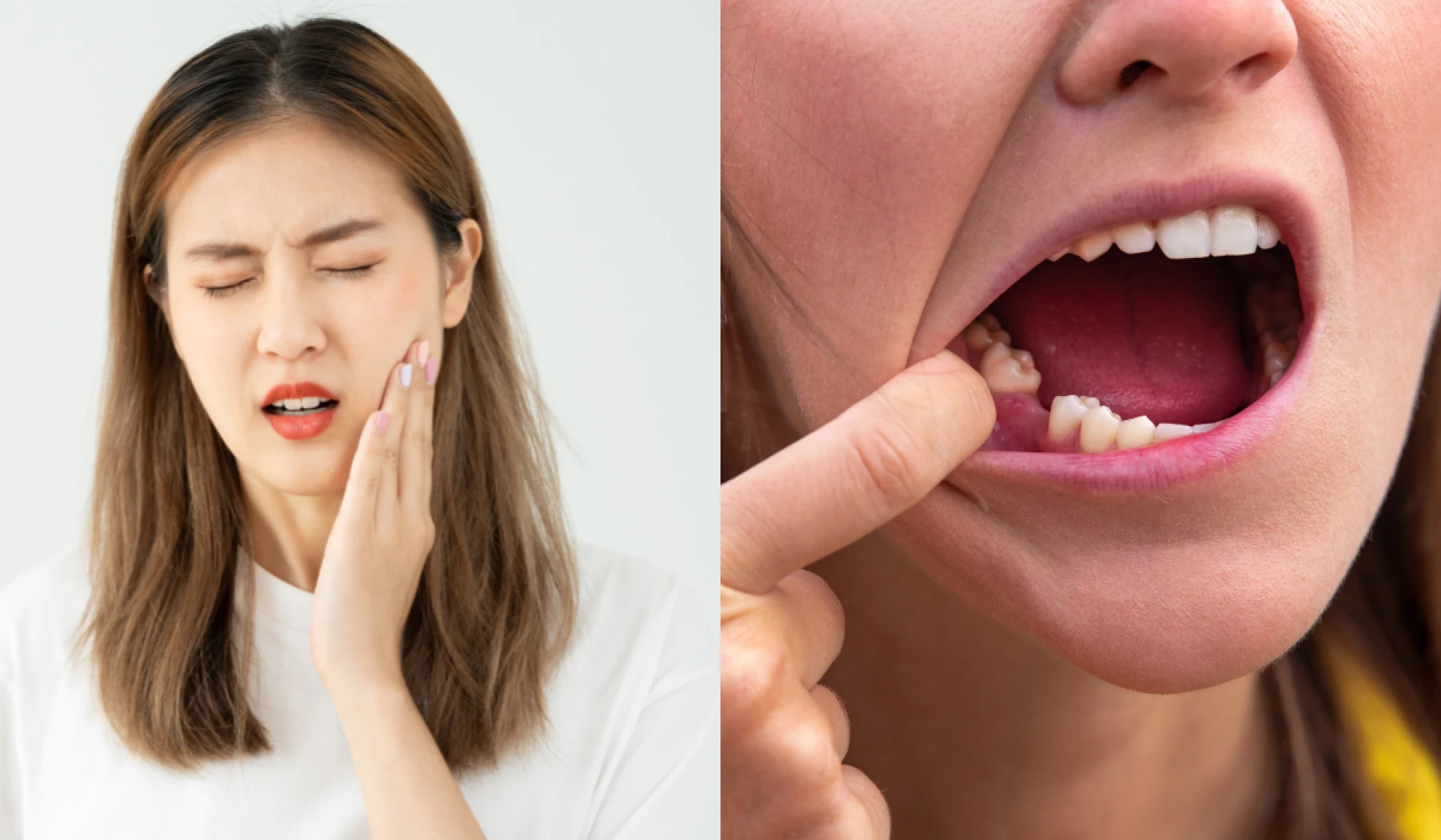 Wisdom Tooth Pain in Lahore Causes Relief and Book an Appointment