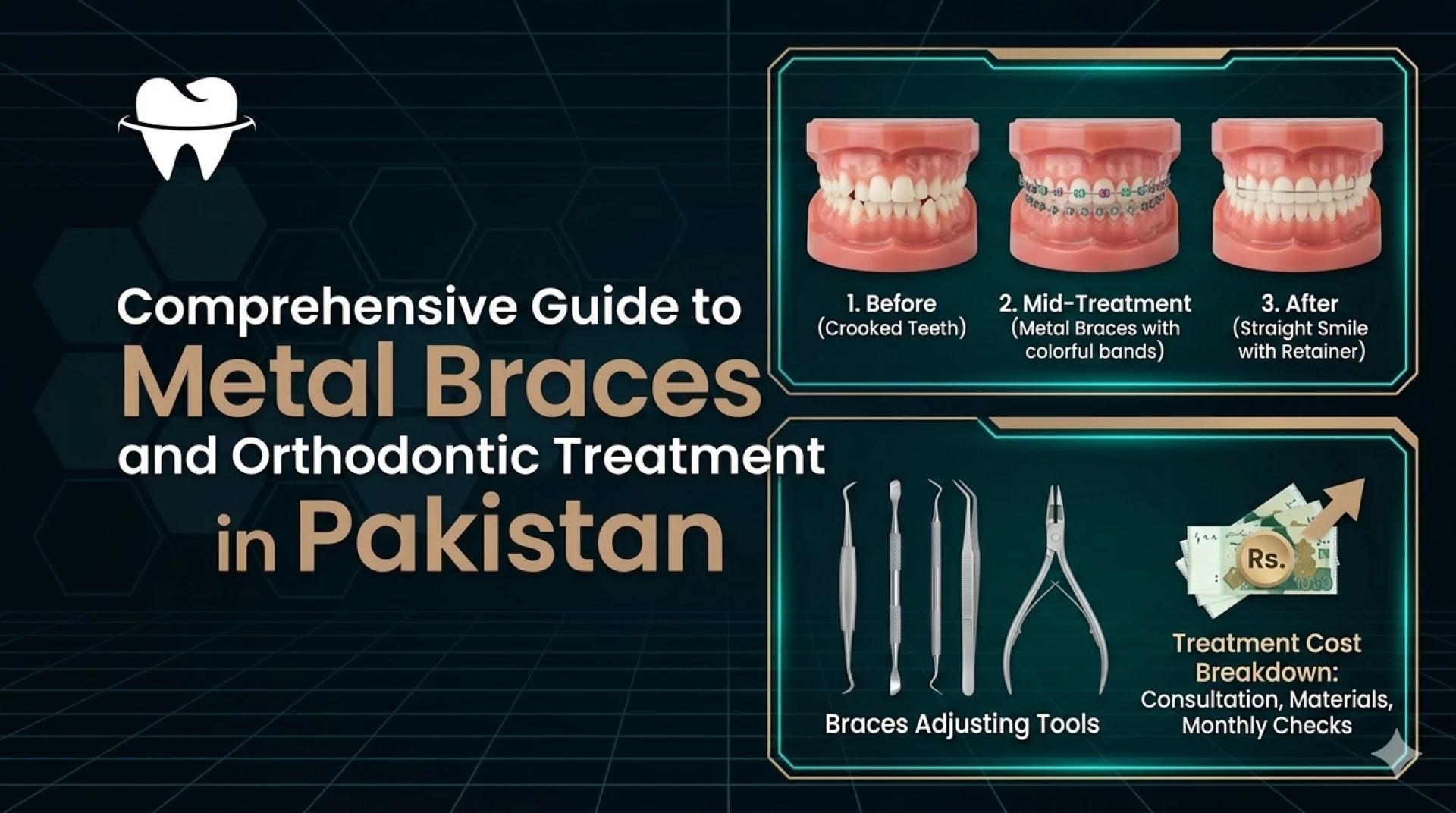 Metal Braces Cost and Orthodontic Treatment Guide in Pakistan