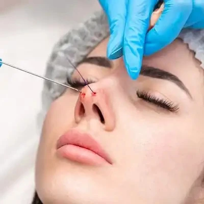 Rhinoplasty in Riyadh: Recovery Timeline and Aftercare Tips