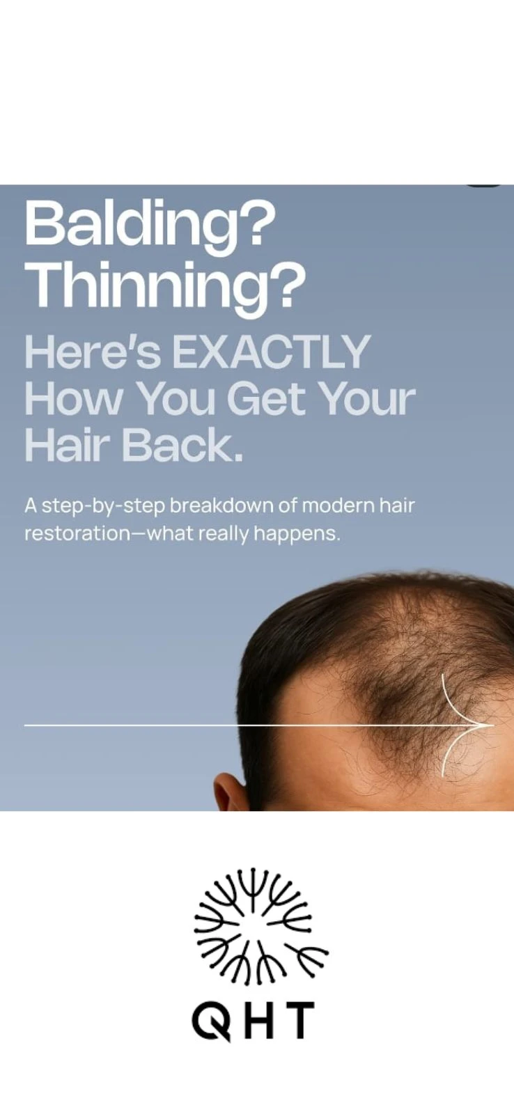 Hair Transplant Second Opinions: Why Getting One Is Always Worth It and What to Look For in Delhi