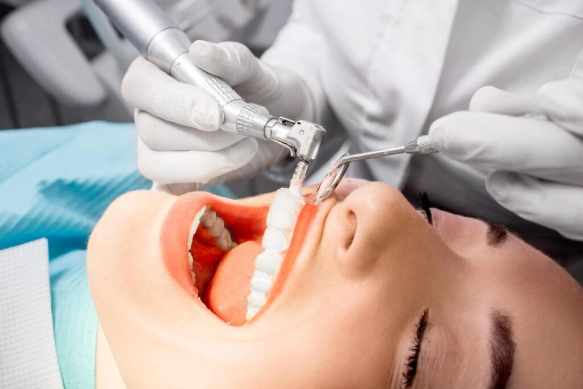 How Often Should You Get Teeth Cleaning? Expert Dentist Guide