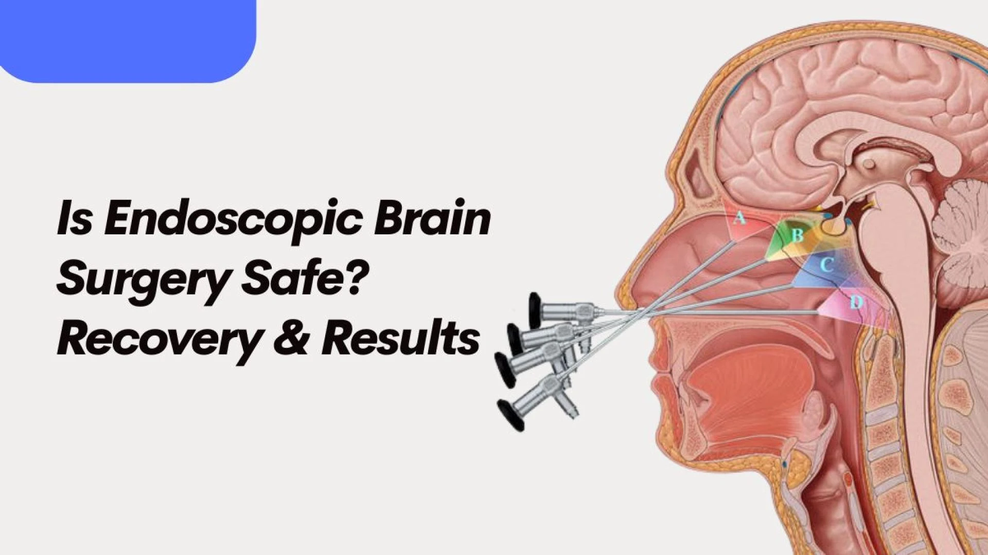 Is Endoscopic Brain Surgery Safe? Recovery & Results