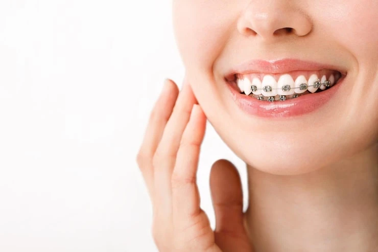 Your Trusted Guide to Ferndale Orthodontics: Achieve a Confident, Healthy Smile
