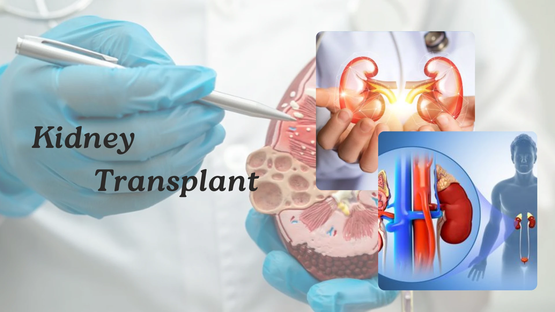 What to Expect from a Kidney Transplant Specialist: A Complete Guide