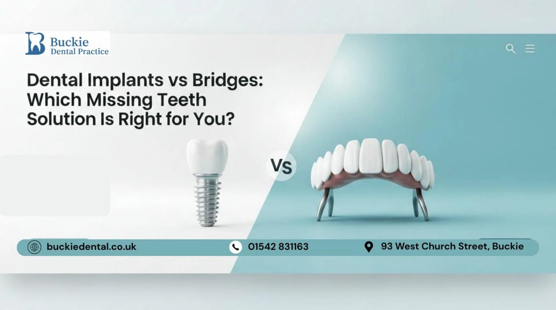 Dental Implants vs Bridges: Which Missing Teeth Solution Is Right for You?