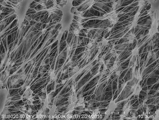 The Perfect Climate: Exploring the Benefits of Breathable Insulation Membranes in Homes