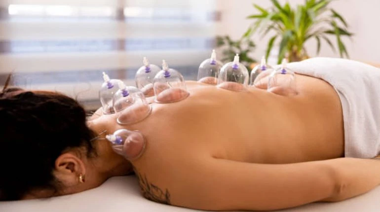 What Is Cupping Therapy? Benefits, Types, and How It Works