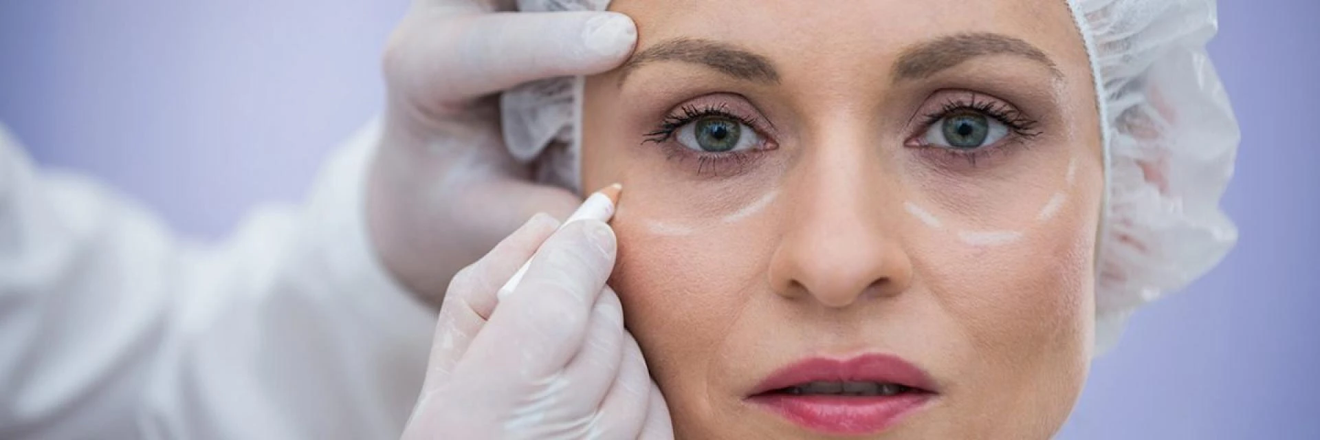 Wake Up Refreshed: How Blepharoplasty in Delhi Enhances Natural Beauty