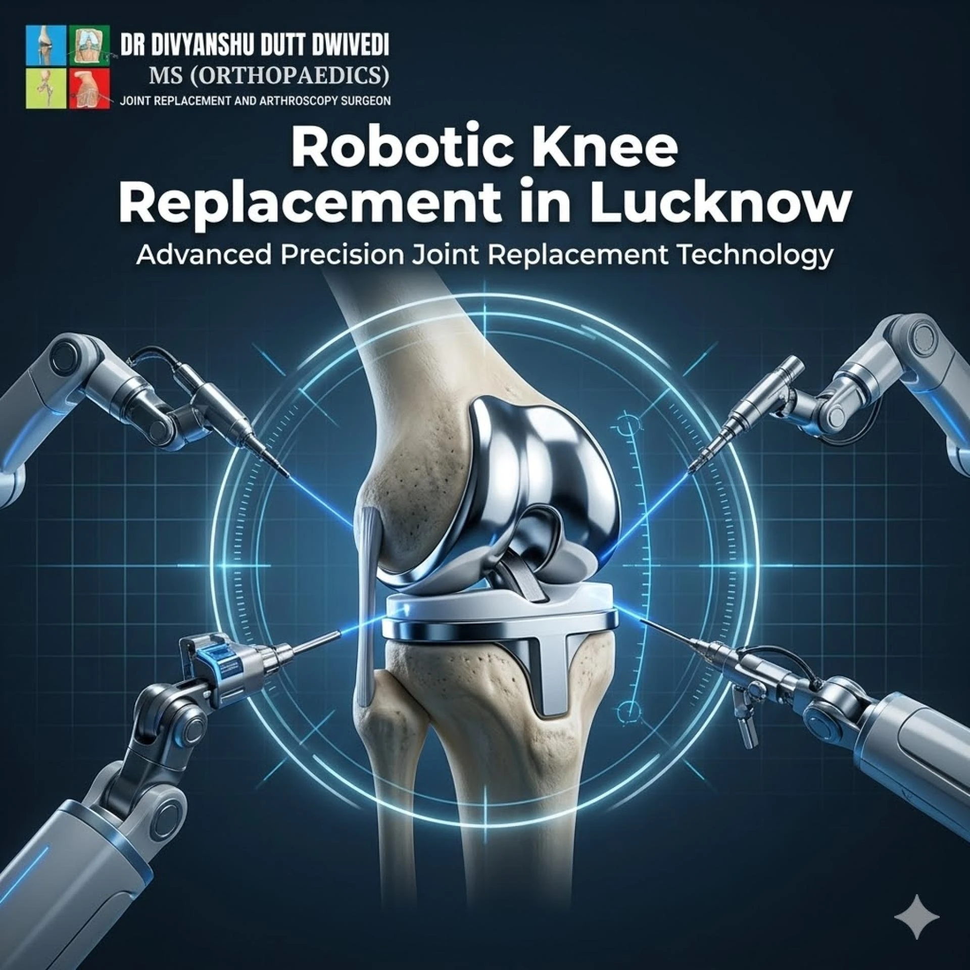 What to Look for When Choosing the Best Doctor for Robotic Knee Replacement in Lucknow