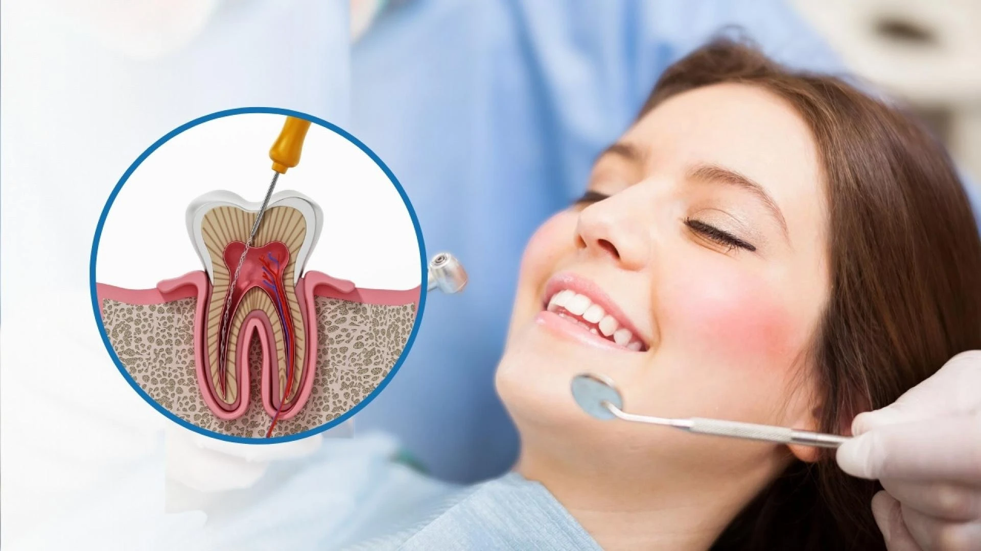The Ultimate Guide to Root Canal Treatment for First-Time Patients