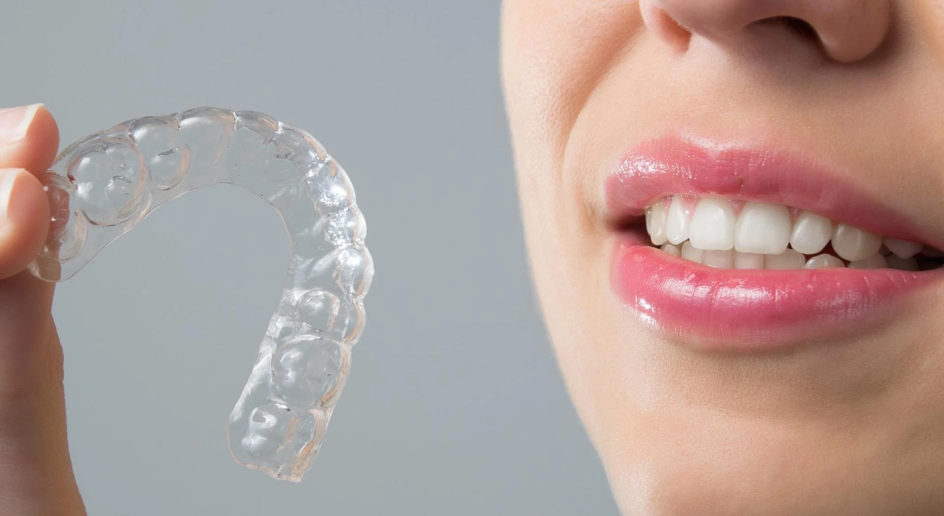How Long Does Aligners Treatment in Narela Take? What to Expect