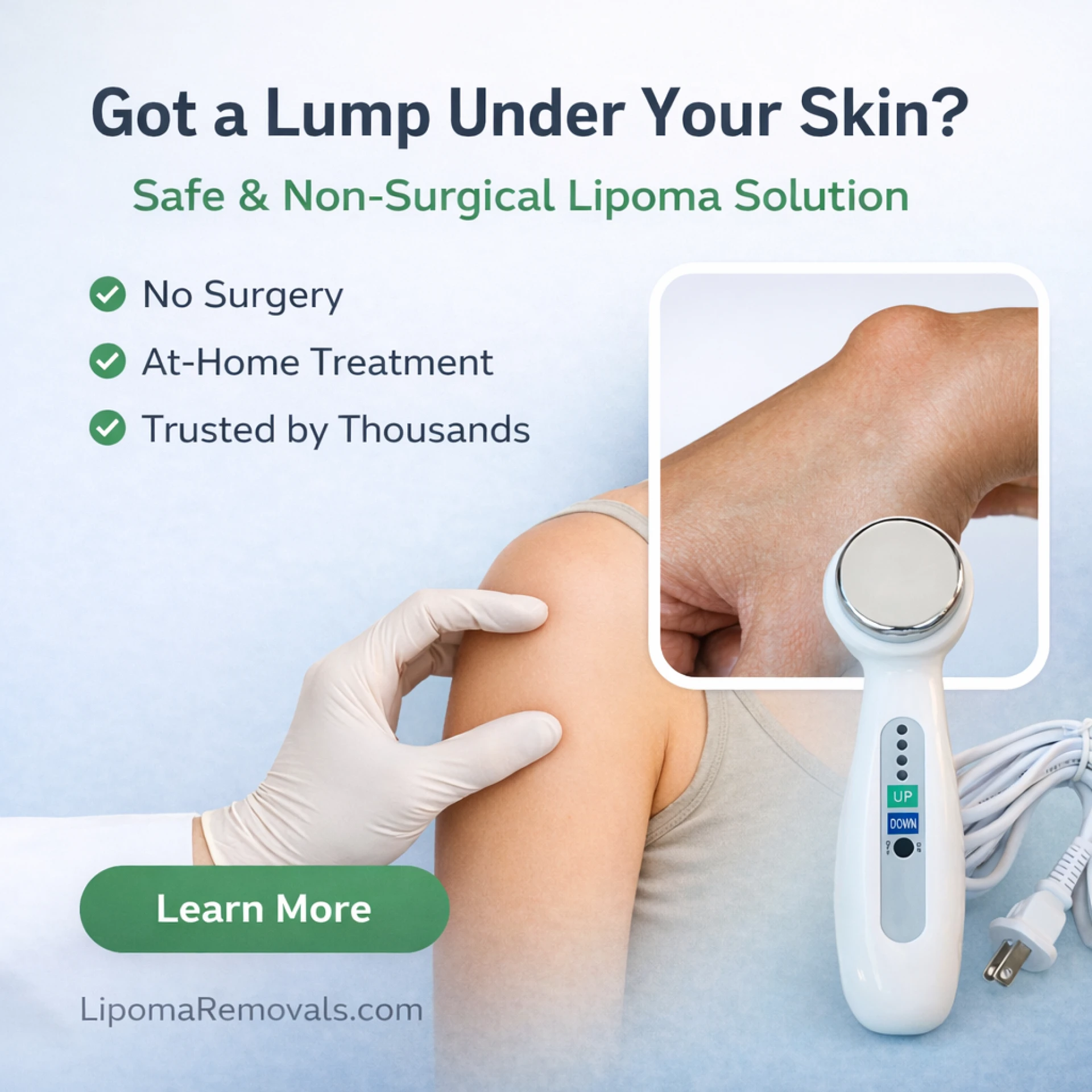 How to Remove Lipoma Naturally: Simple & Effective Ways You Can Try at Home