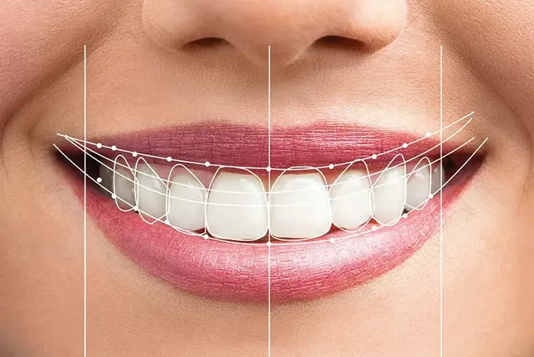 Improving Quality of Life with Full Mouth Rehabilitation Treatment in Badlapur